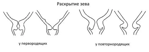 провісник пологів