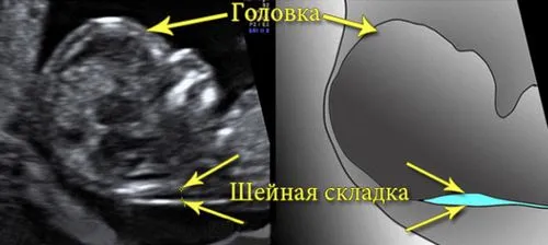 норми