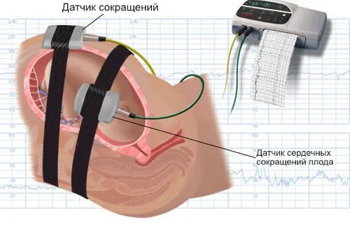 рухи дитини при вагітності