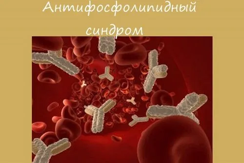 завмерла вагітність причини