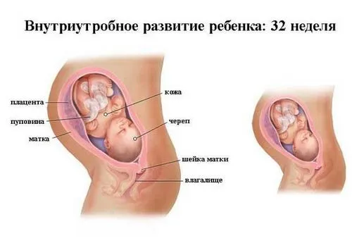 вагітність 32 тижні