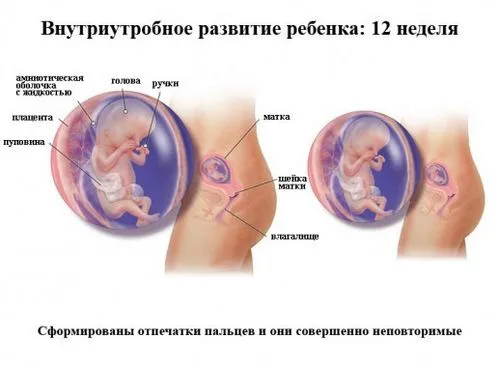 перший скринінг вагітності