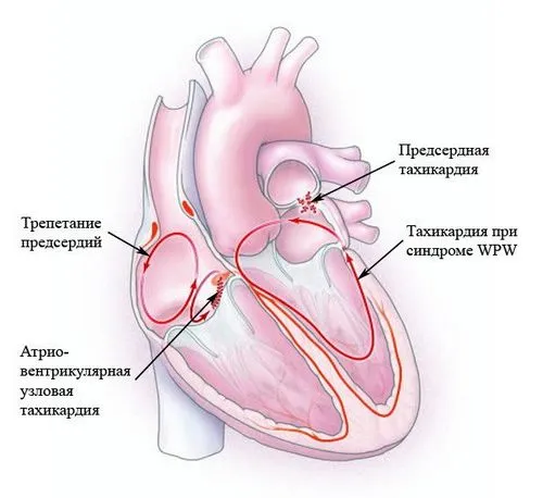 низький гемоглобін у вагітних симптоми