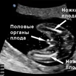 17 тиждень вагітності симптоми