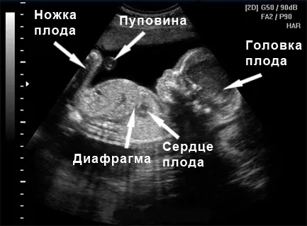 22 тиждень вагітності вага