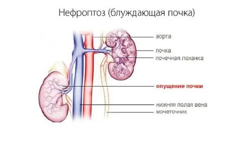 біль при вагітності з лівого боку