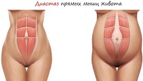 вагітність після пологів симптоми