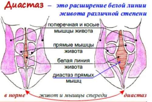 вагітність після пологів симптоми