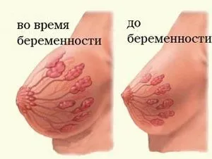 набряк грудей під час вагітності