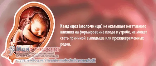 як впливає молочниця вагітність