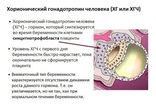 вагітність без симптомів