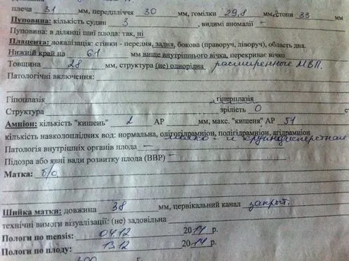 узі 20 тижнів вагітності узі 20 тижнів вагітності