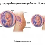23 тиждень вагітності харчування, 23 тиждень вагітності 23 тиждень вагітності харчування