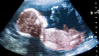 19 тижнів вагітності