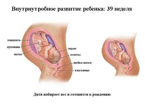 12 тиждень вагітності тягне живіт
