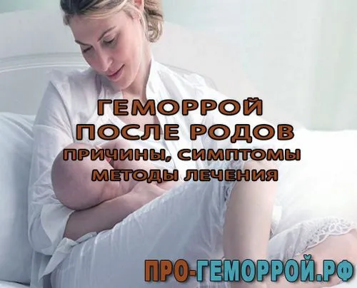 геморой після пологів що робити, геморой після пологів причини симптоми лікування гігієна післяпологовий період геморой після пологів причини симптоми лікування гігієна післяпологовий період