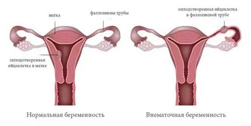 області