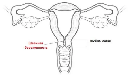 на якому терміні можна виявити вагітність узі