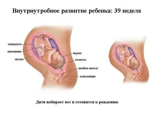 провісники пологів у первісток