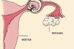 аналіз крові на вагітність