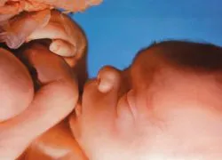 17 тиждень вагітності руху дитини
