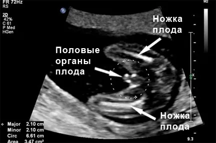 вагітність 17 тижнів фото вагітність 17 тижнів фото