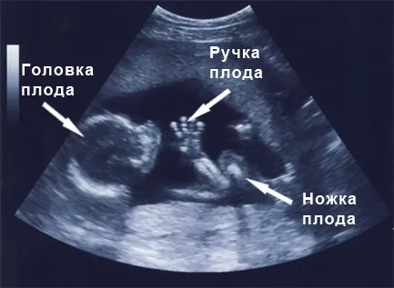 вагітність 17 тижнів фото вагітність 17 тижнів фото
