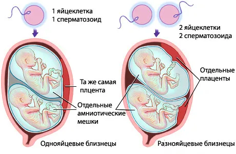 безпліддя, вагітність, еко еко