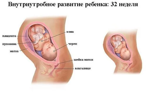 узі 32 тижня вагітності розшифровка плода ДПП показники товщина плаценти 12 дані другої таблиці 31 КТГ балів доплером норми результат