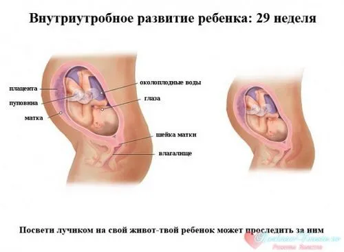 29 тиждень вагітності болю