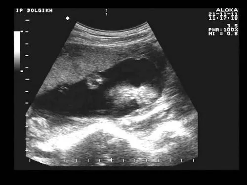 5 місяць вагітності - час пізнання один одного