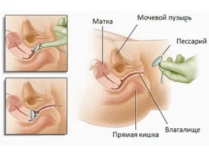 шийка матки при вагітності
