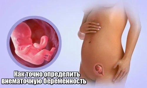 як визначити вагітність на ранніх стадіях