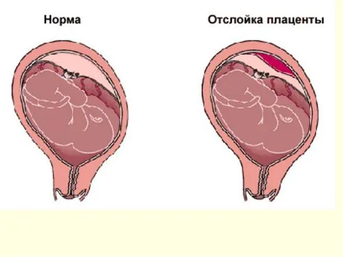 33 тижні вагітності