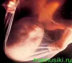двадцять п'ятий тиждень вагітності двадцять п'ятий тиждень вагітності