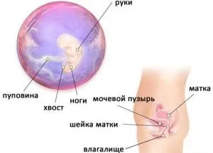 6 тиждень вагітності симптоми 6 тиждень вагітності симптоми