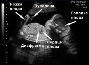 22 тиждень вагітності узі