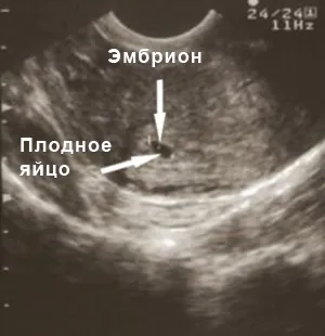 лікаря