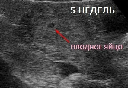 терміні
