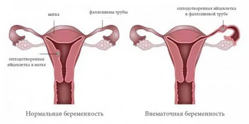 як підготуватися до узі під час вагітності