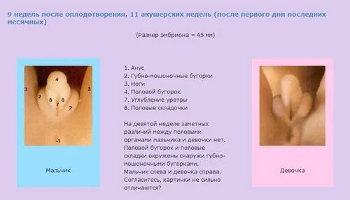 ознаки вагітності хлопчиком ознаки вагітності хлопчиком