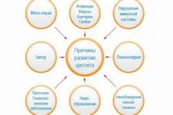 як лікувати цистит при вагітності