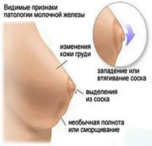 як виявити вагітність на ранній стадії
