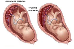 перший по підлозі