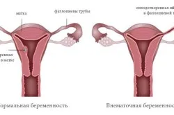 перший по підлозі