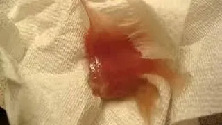 відео, відео як відходять води у вагітних, безкоштовно, дивитися, відеоролики, youtube, ютуб відео
