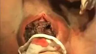 відео, відео як відходять води у вагітних, безкоштовно, дивитися, відеоролики, youtube, ютуб відео