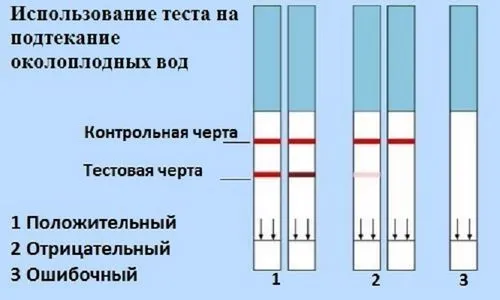 виділення при вагітності зеленого кольору