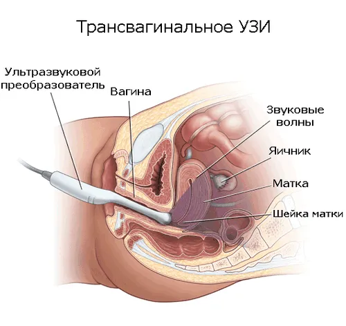 підготовка до першого узі при вагітності