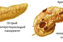 перший по підлозі